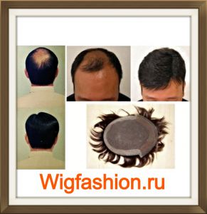МОНО -9761 Натуральная накладка на лысину (Унисекс) ― Wigfashion